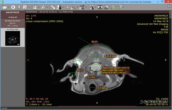 RadiAnt DICOM Viewer Crack With Serial Key 2022